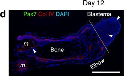 Immunohistochemistry of Anti-Collagen Type IV