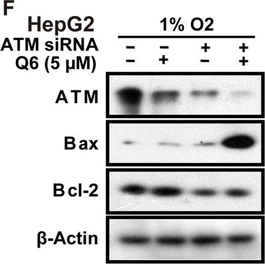 Western Blot of Anti-ATM