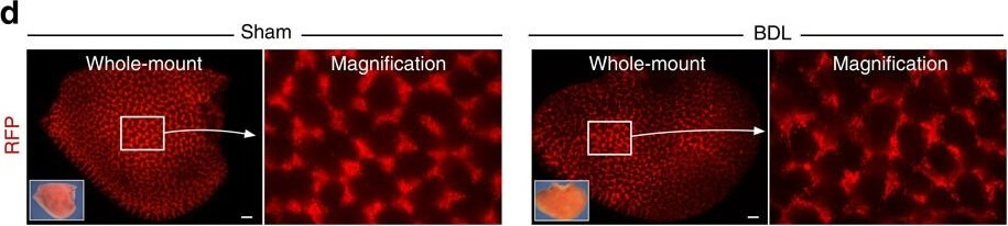 Immunohistochemistry of Anti-RFP