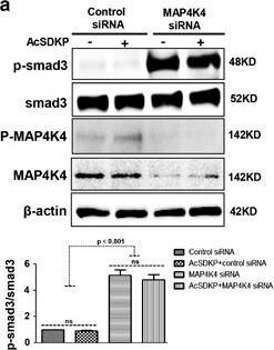 Western Blot of Anti-SMAD3 pS423 pS425