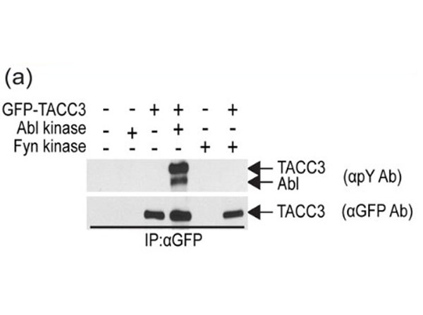 Immunoprecipitation using Protein A