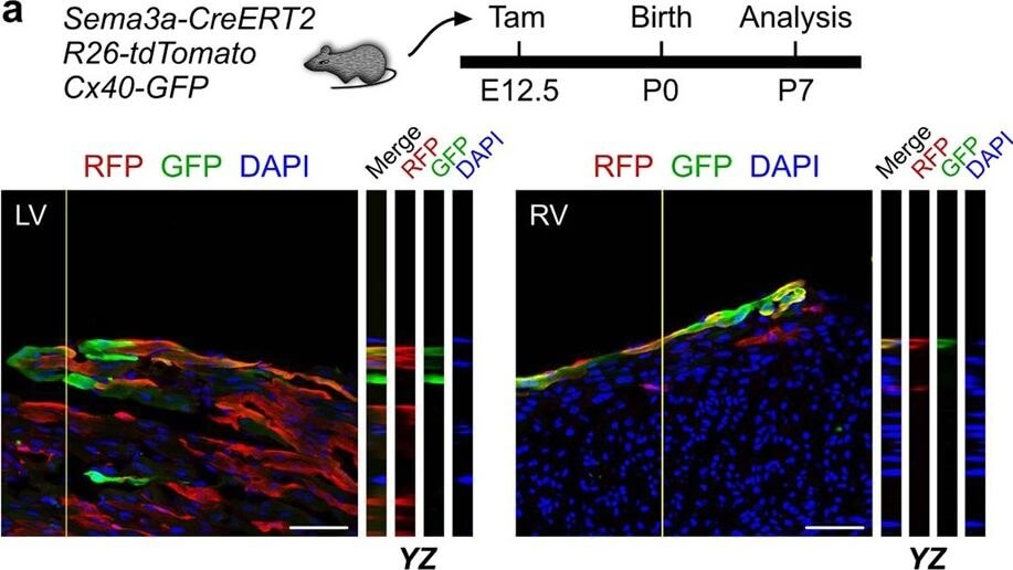 Immunohistochemistry of Anti-RFP