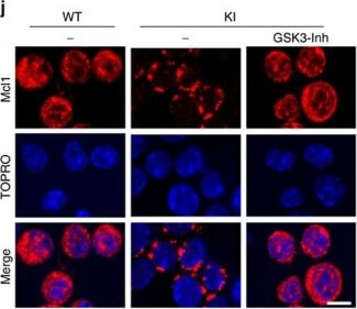 Immunocytochemistry of Anti-Mcl-1