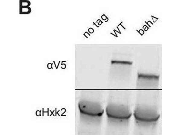 Western Blot of Anti-Hexokinase Antibody