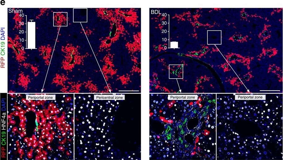 Immunohistochemistry of Anti-RFP