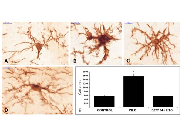 Immunohistochemistry using Streptavidin
