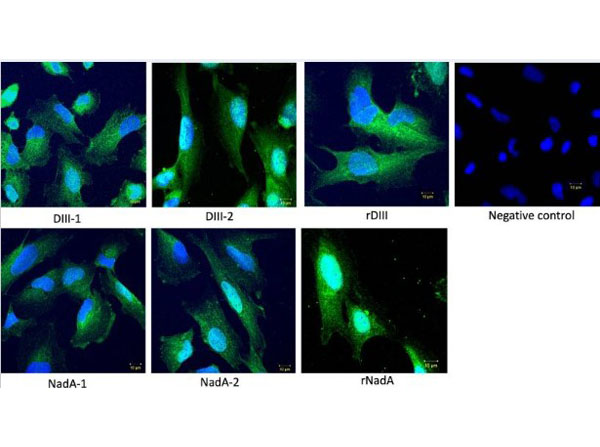 Immunofluorescence using Streptavidin Fluorescein