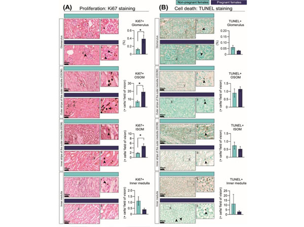 Immunohistochemistry using Streptavidin Peroxidase
