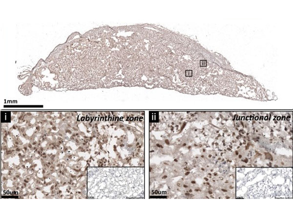 Immunohistochemistry using Streptavidin Peroxidase