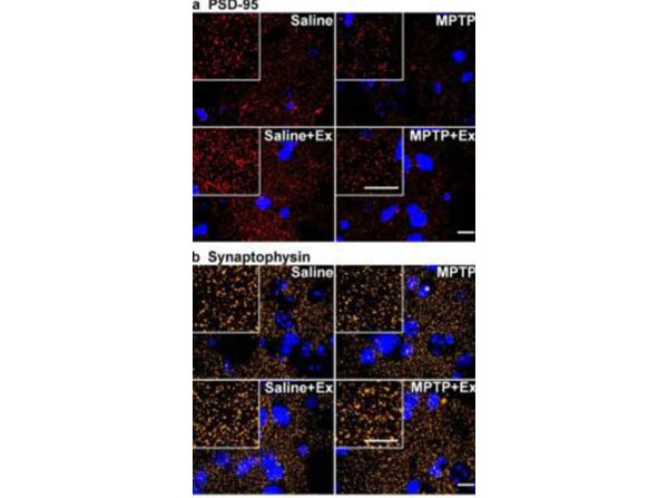 Immunofluorescence using Streptavidin CY5