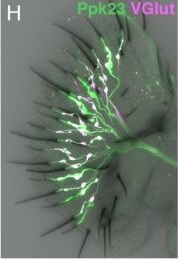 Immunohistochemistry of Anti-RFP
