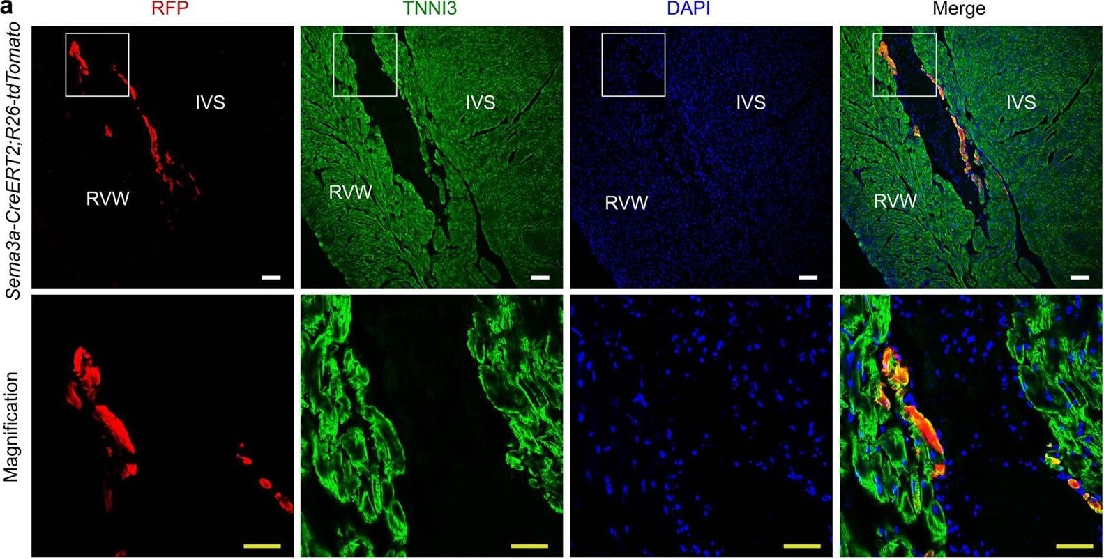 Immunohistochemistry of Anti-RFP