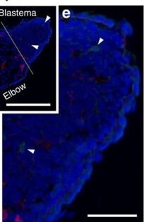 Immunohistochemistry of Anti-Collagen Type IV