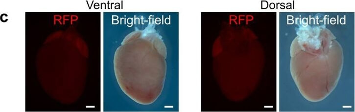 Immunohistochemistry of Anti-RFP