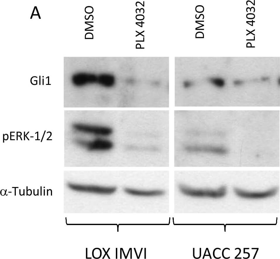 Western Blot of Anti-Gli1