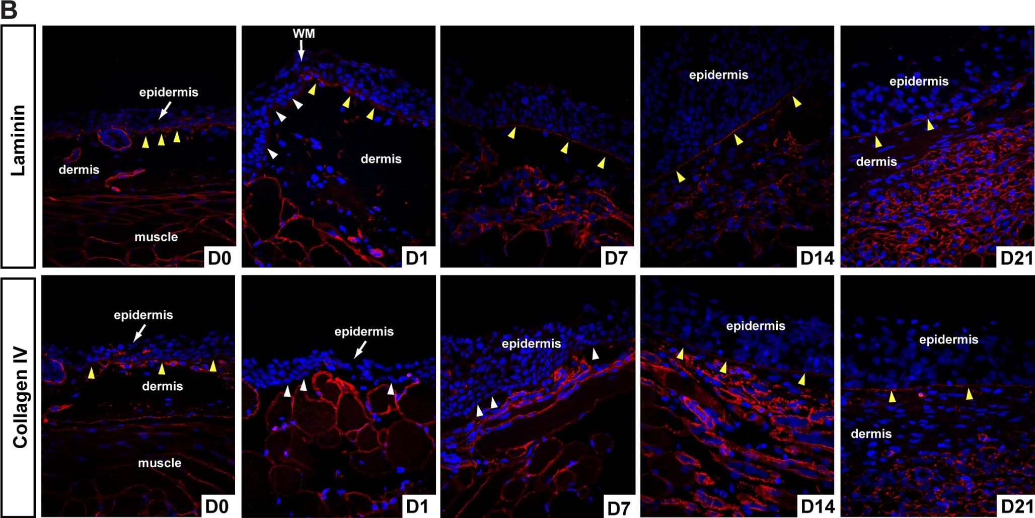 Immunohistochemistry of Anti-Collagen Type IV