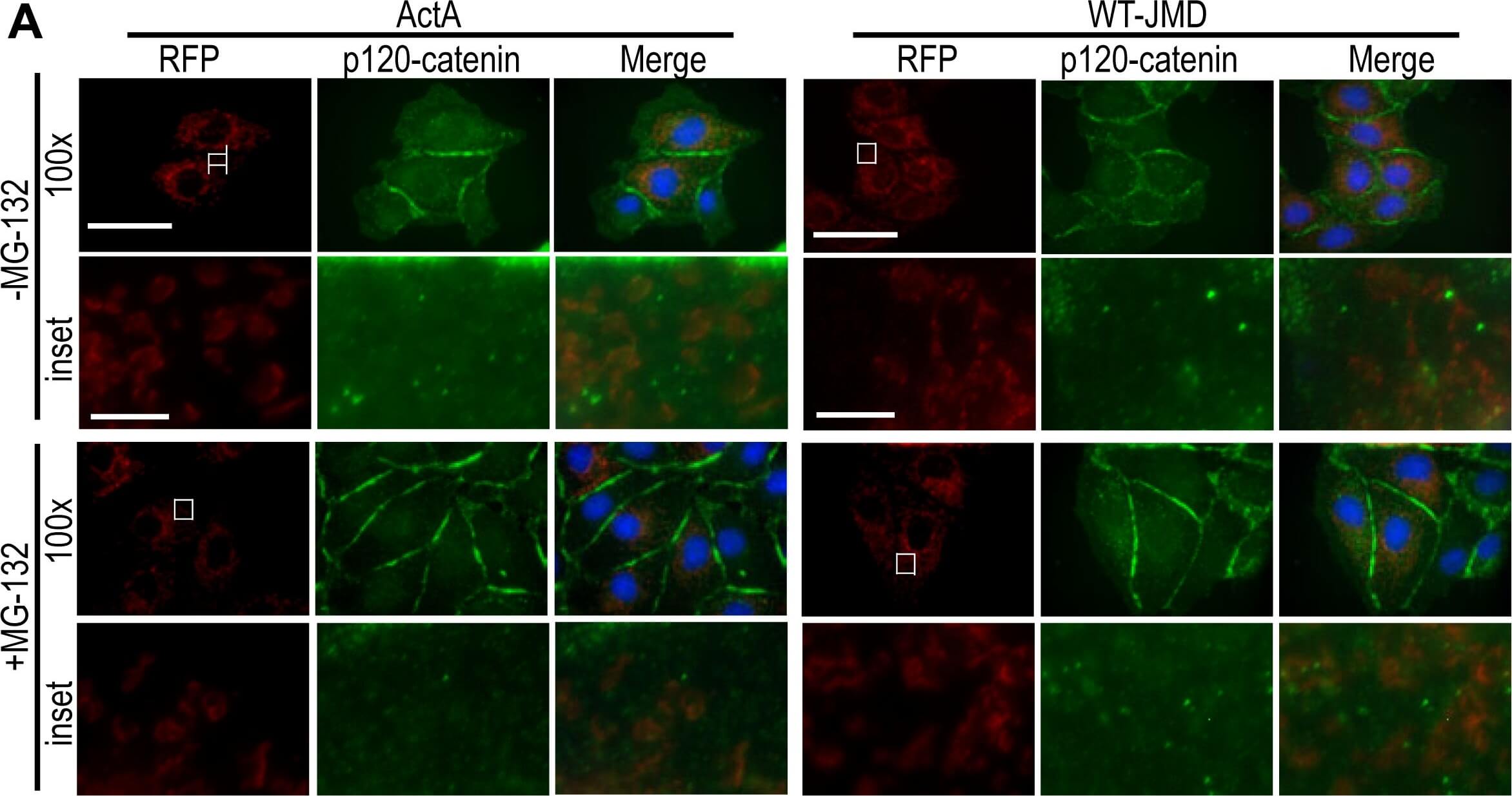 Immunocytochemistry of Anti-RFP