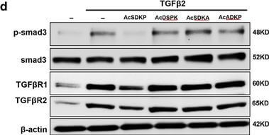 Western Blot of Anti-SMAD3 pS423 pS425