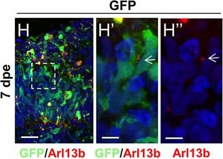 Immunohistochemistry of Anti-RFP