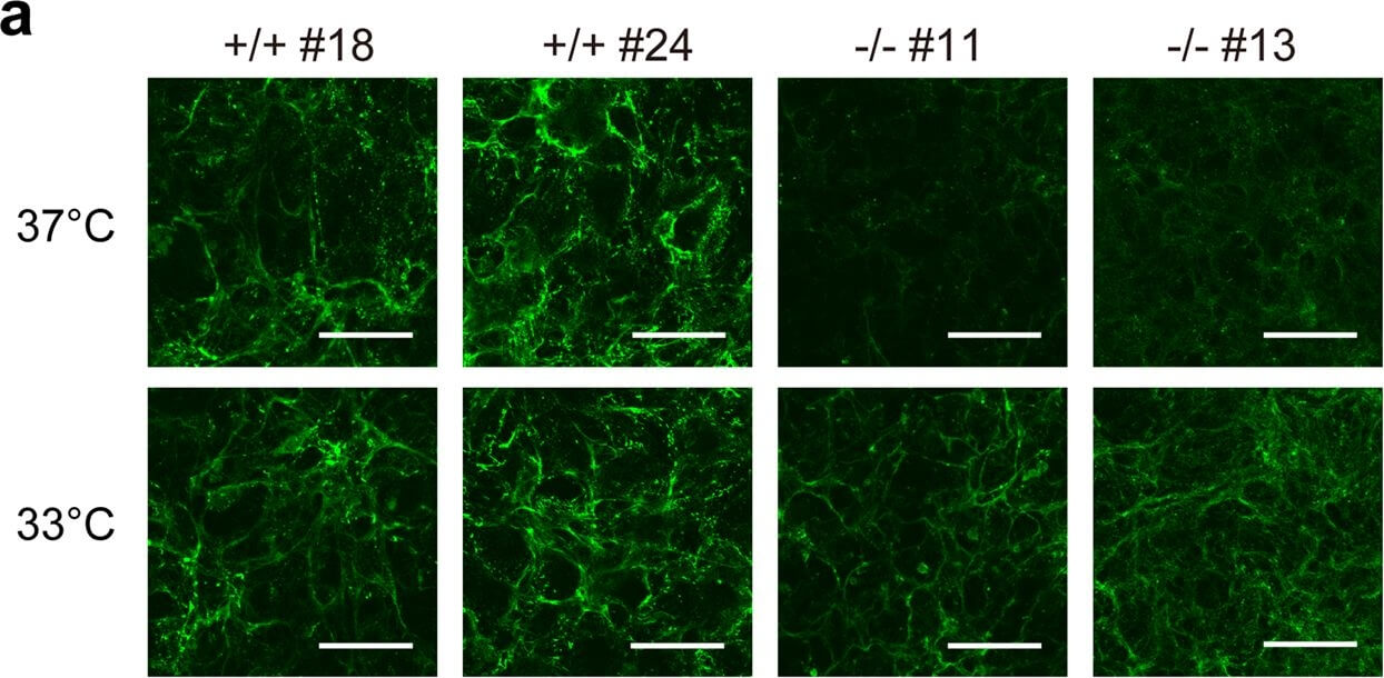 Immunocytochemistry of Anti-Collagen Type I