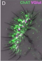 Immunohistochemistry of Anti-RFP