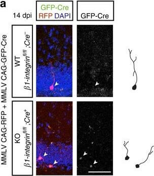 Immunohistochemistry of Anti-RFP