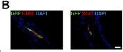 Immunohistochemistry of Anti-GFP